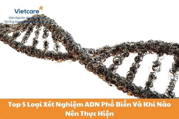 Top 5 Loại Xét Nghiệm ADN Phổ Biến Và Khi Nào Nên Thực Hiện 12 Top 5 Loại Xét Nghiệm ADN Phổ Biến Và Khi Nào Nên Thực Hiện