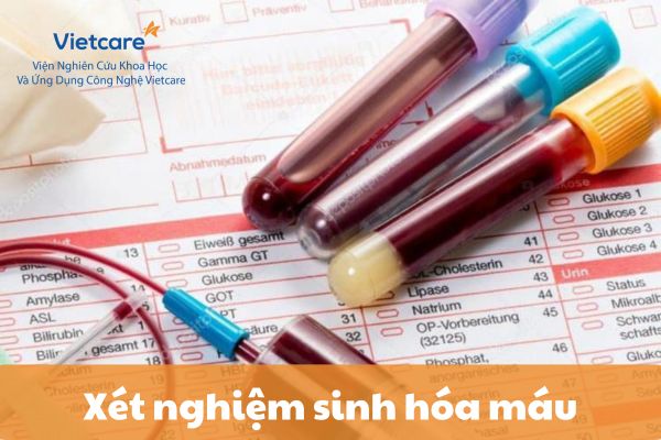 Xét nghiệm sinh hóa máu