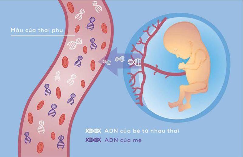 Quy trình thực hiện xét nghiệm NIPT