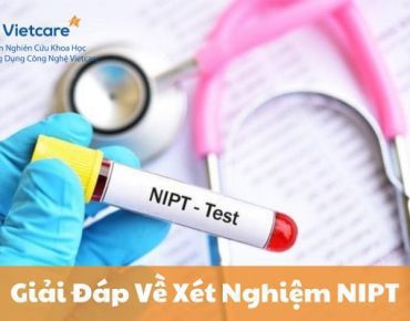 Giải Đáp Về Xét Nghiệm NIPT: Tất Cả Những Gì Bạn Cần Biết