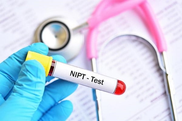 Xét nghiệm Sàng lọc trước sinh không xâm lấn (NIPT - Non-Invasive Prenatal Testing