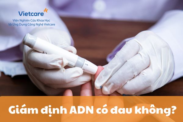 Giám định ADN có đau không?