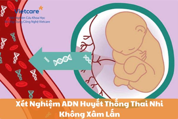 Xét Nghiệm ADN Huyết Thống Thai Nhi Không Xâm Lấn