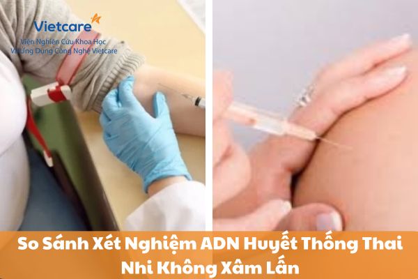 So Sánh Xét Nghiệm ADN Huyết Thống Thai Nhi Không Xâm Lấn với Các Phương Pháp Khác