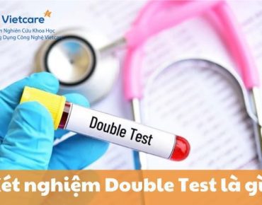 Xét nghiệm Double Test - Xét nghiệm sàng lọ di tật thai nhi