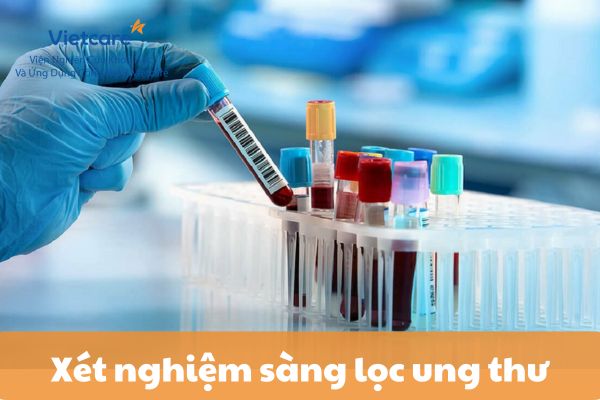 Xét nghiệm sàng lọc ung thư