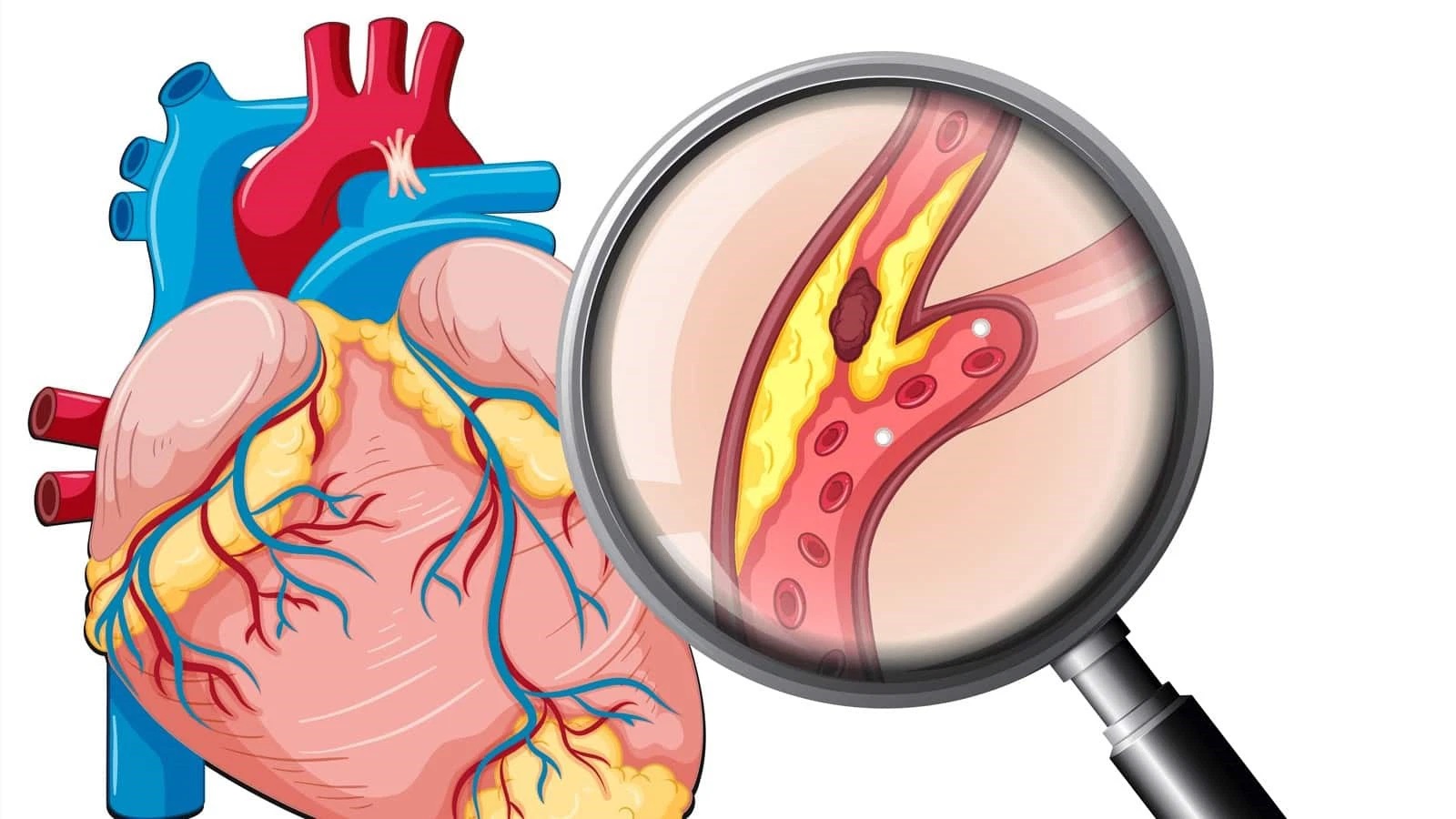 Chỉ số cholesterol và triglyceride