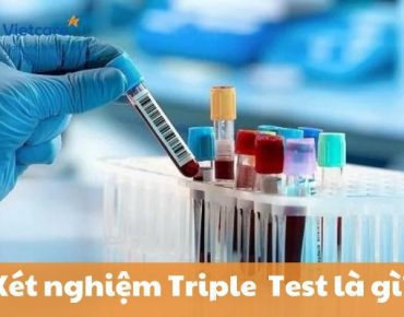 Xét nghiệm Triple Test - Xét nghiệm sàng lọc dị tất thai nhi