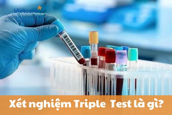 Xét nghiệm Triple Test - Xét nghiệm sàng lọc dị tất thai nhi