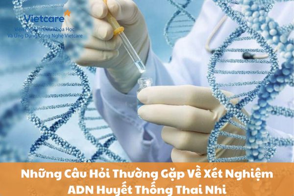 Những Câu Hỏi Thường Gặp Về Xét Nghiệm ADN Huyết Thống Thai Nhi