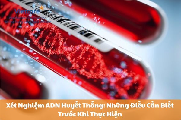 Xét Nghiệm ADN Huyết Thống: Những Điều Cần Biết Trước Khi Thực Hiện