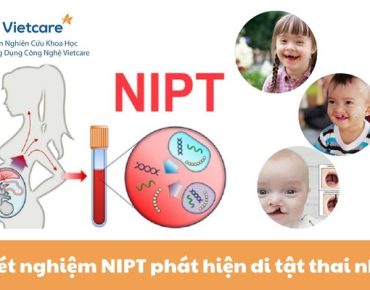 Xét nghiệm NIPT phát hiện dị tật thai nhi