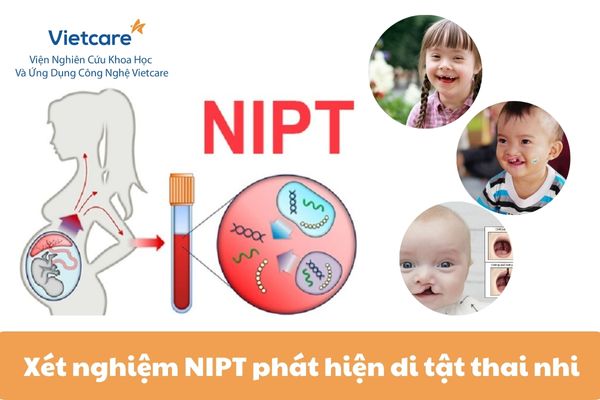 Xét nghiệm NIPT phát hiện dị tật thai nhi