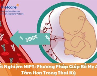 Xét Nghiệm NIPT: Phương Pháp Giúp Bố Mẹ An Tâm Hơn Trong Thai Kỳ