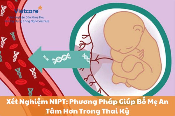 Xét Nghiệm NIPT: Phương Pháp Giúp Bố Mẹ An Tâm Hơn Trong Thai Kỳ