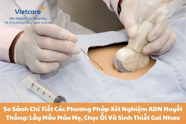 So Sánh Chi Tiết Các Phương Pháp Xét Nghiệm ADN Huyết Thống: Lấy Mẫu Máu Mẹ, Chọc Ối Và Sinh Thiết Gai Nhau