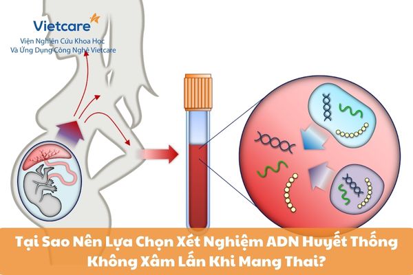 Tại Sao Nên Lựa Chọn Xét Nghiệm ADN Huyết Thống Không Xâm Lấn Khi Mang Thai