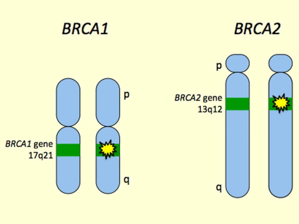 Mối quan hệ giữa Gen BRCA1 và BRCA2 trong Ung thư vú