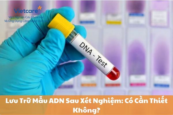 Lưu Trữ Mẫu ADN Sau Xét Nghiệm: Có Cần Thiết Không?